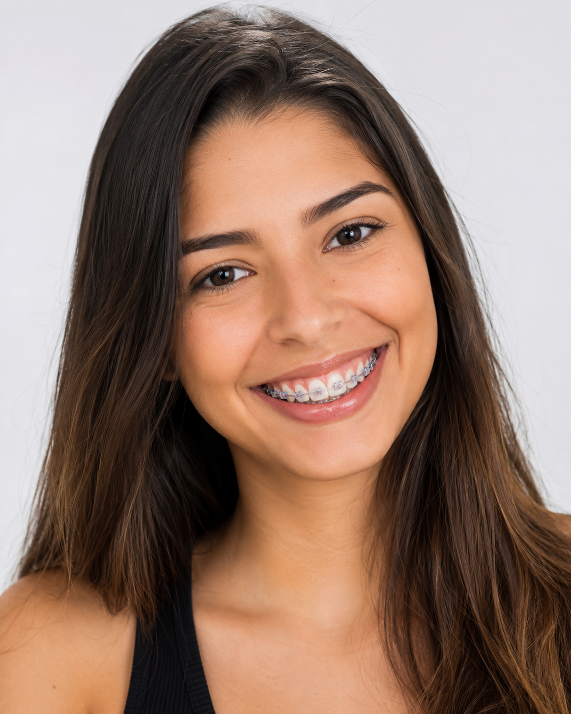 Jovem sorrindo com aparelho fixo